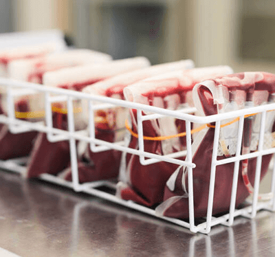 KAN MERKEZİ VE TRANSFÜZYON